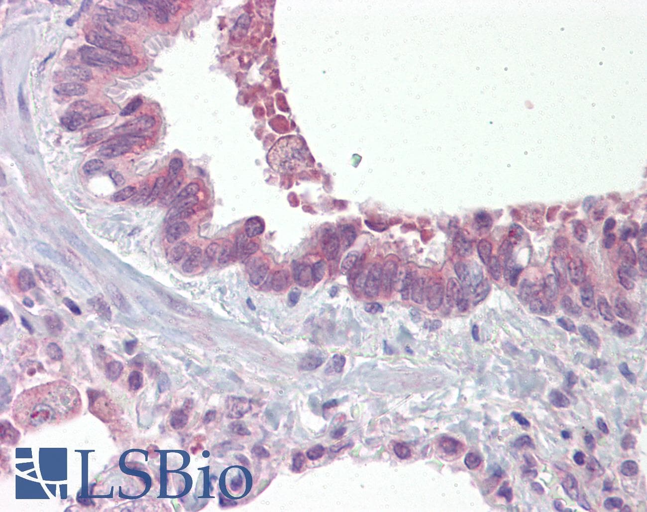 IHC-plus™ Polyclonal Rabbit anti-Human VIPR1 Antibody (Internal, IHC, WB)