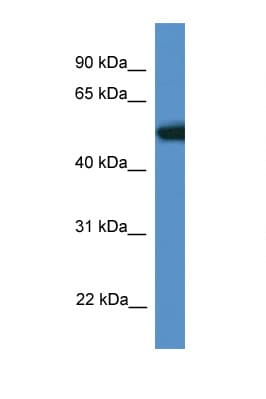 Polyclonal Rabbit anti-Mouse TIGD4 Antibody (aa110-159, WB)