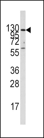 IDE Antibody (aa406-435)