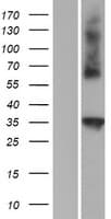 C1QTNF4 / CTRP4 Protein (Over-Expression Lysate Myc-DDK (Flag))
