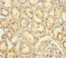Polyclonal Rabbit anti-Human PRPF4 Antibody (IHC, WB)