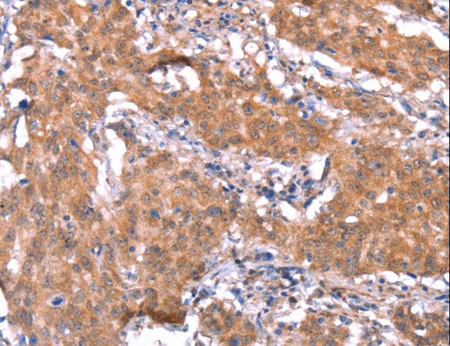 FAM13B Antibody