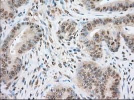 ERIC-1 / TACC3 Antibody (clone OTI6C6)