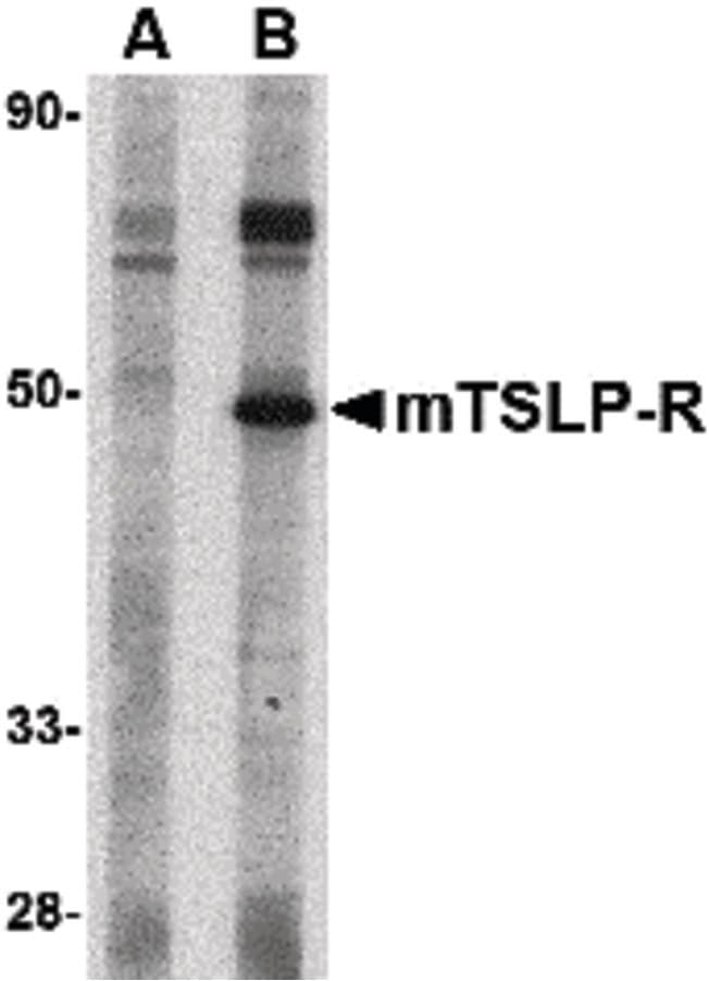 Polyclonal Rabbit anti-Mouse CRLF2 / TSLPR Antibody (IF, WB)