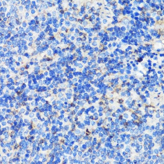 FLNA / Filamin A Antibody