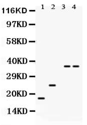 PLN / Phospholamban Antibody (aa1-35)