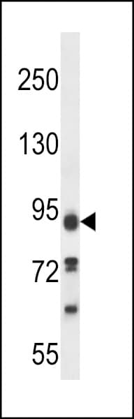 Polyclonal Rabbit anti-Human PALD1 / Paladin 1 Antibody (aa810-839, IHC, WB)