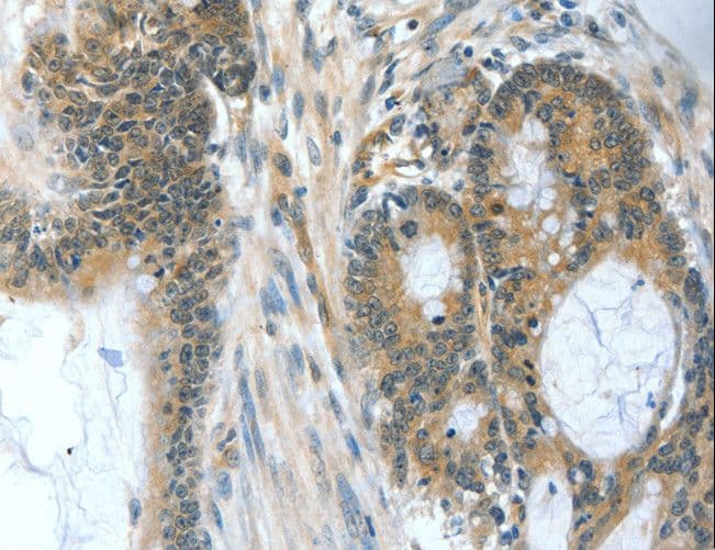 Polyclonal Rabbit anti-Human BAD Antibody (IHC)