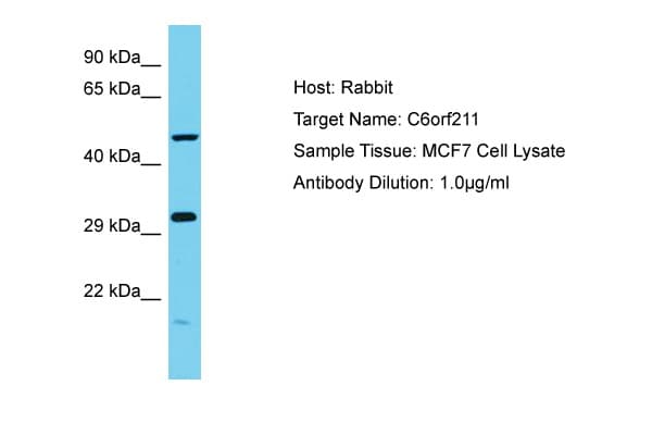 ARMT1 Antibody (aa102-151)