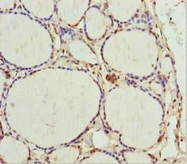 AK6 / Adenylate Kinase 6 Antibody