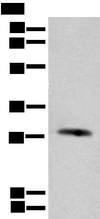 CFHR2 Antibody