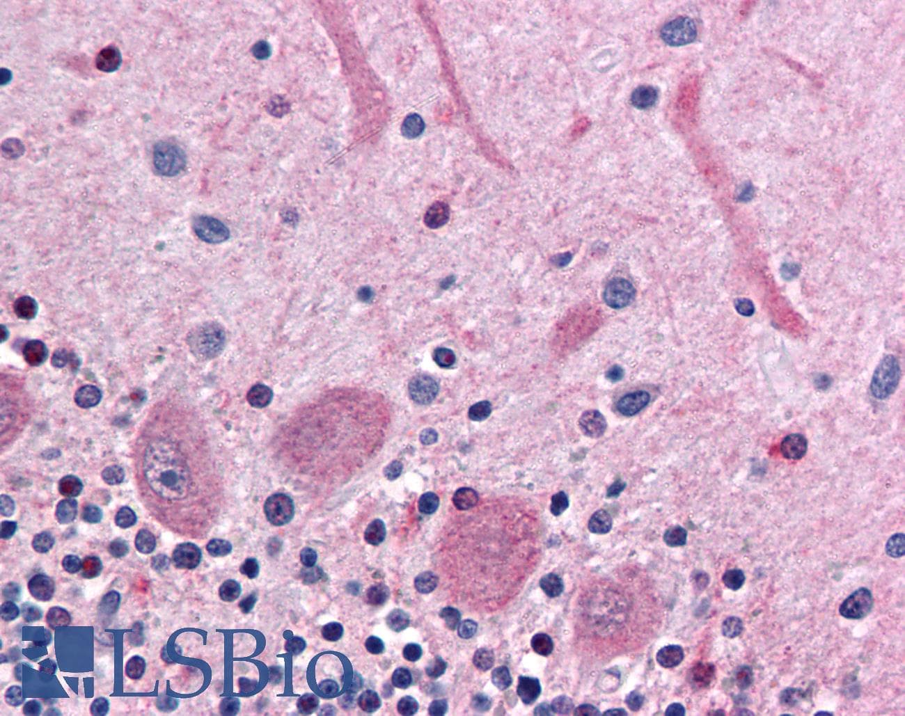 IHC-plus™ COMT Antibody (Internal)
