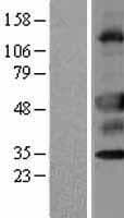 UNC5CL Protein (Over-Expression Lysate Myc-DDK (Flag))