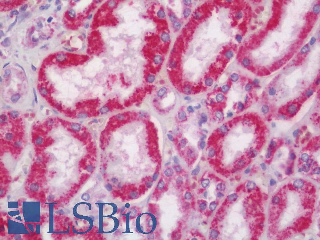 IHC-plus™ Polyclonal Rabbit anti-Human PRDX3 / Peroxiredoxin 3 Antibody (aa44-93, IHC, WB)