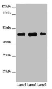 SS18L1 / CREST Antibody