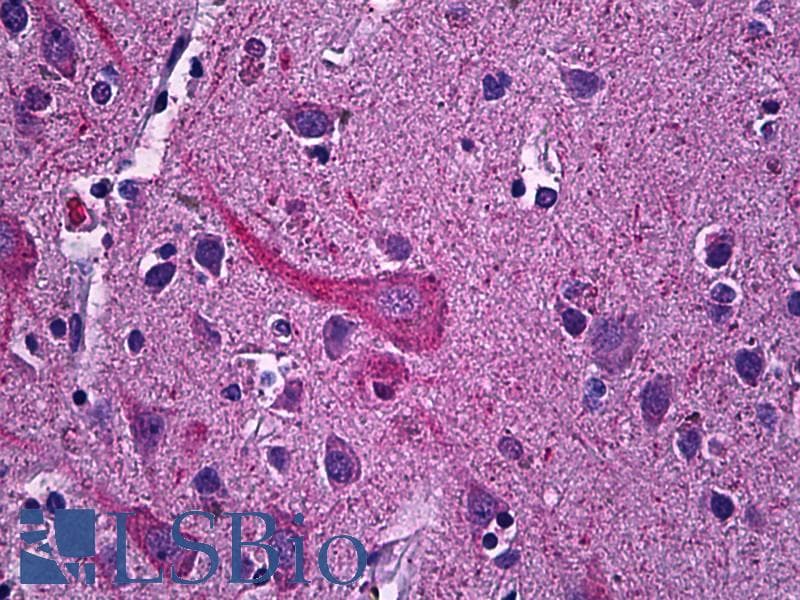 IHC-plus™ Polyclonal Goat anti-Human SYT1 / Synaptotagmin Antibody (aa261-273, IHC, WB)