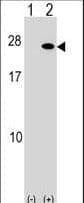 FGF19 Antibody (aa175-202)