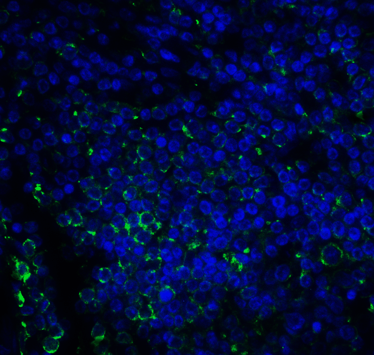 Monoclonal Mouse anti-Human CD276 / B7-H3 Antibody (clone 2A7, IHC, IF, WB)