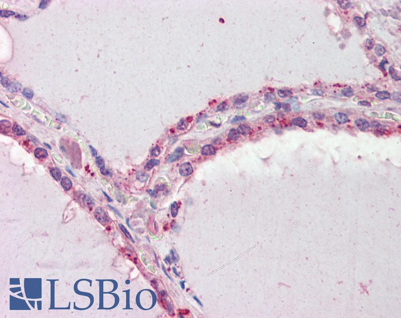 IHC-plus™ DAPK2 / DAP Kinase 2 Antibody (aa359-370)