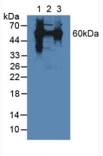 HSPD1 / HSP60 Antibody (aa316-573)