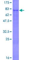 Human SPOCK3 Protein (Recombinant GST)