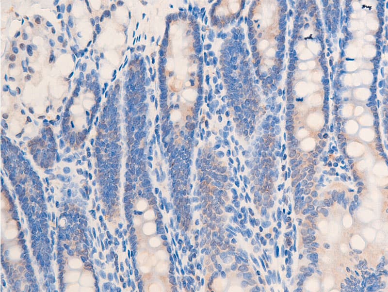 CHEK2 / CHK2 Antibody (phospho-Thr68)