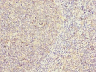 Polyclonal Rabbit anti-Human CAMSAP2 Antibody (IHC)
