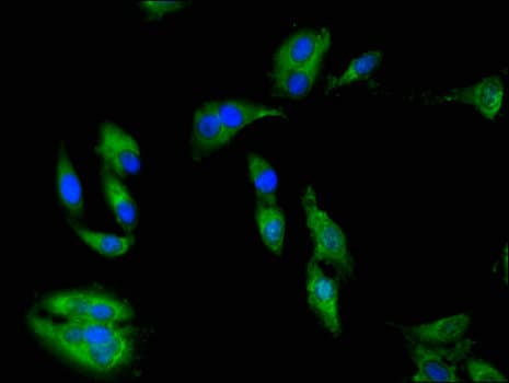 PRKAA1 / AMPK Alpha 1 Antibody