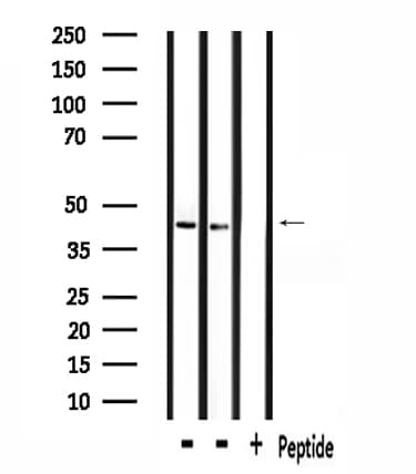 ZADH2 Antibody