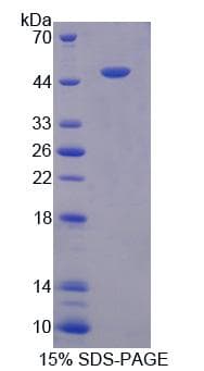 Rat CHRNA10 Protein (Recombinant)