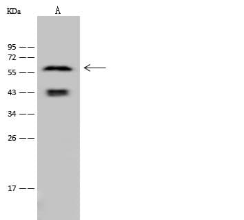 Polyclonal Rabbit anti-Human KRT6A / CK6A / Cytokeratin 6A Antibody (WB)