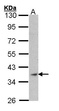 ACTA1 / Skeletal Muscle Actin Antibody (aa146-355)