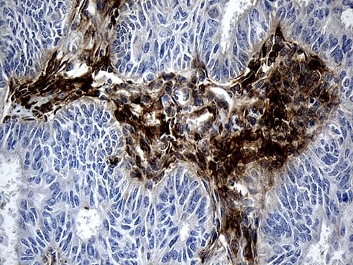 Monoclonal Mouse anti-Human MGP / Matrix Gla-Protein Antibody (clone OTI8D6, IHC, WB)