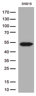 Monoclonal Mouse anti-Human GFAP Antibody (clone UMAB5, IHC, IF, WB)