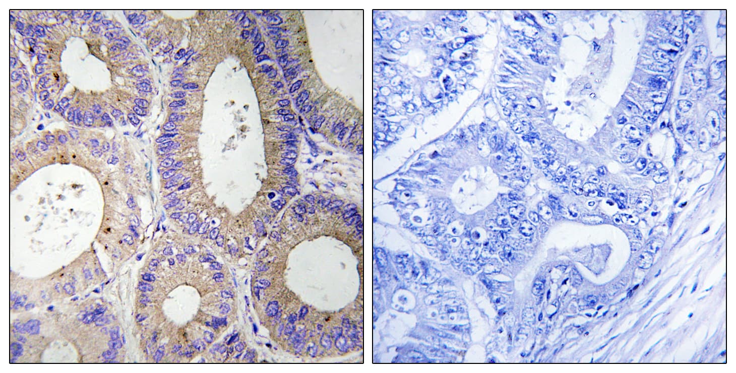 CBR3 Antibody (aa151-200)