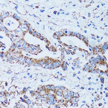 Polyclonal Rabbit anti-Human Gastric Inhibitory Peptide Antibody (IHC, IF, WB)