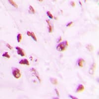 TP73 / p73 Antibody (phospho-Tyr99)
