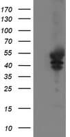 Monoclonal Mouse anti-Human VASP Antibody (clone OTI1F3, IHC, WB)