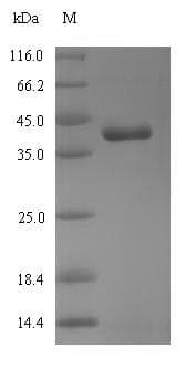 Chicken RHOT1 Protein (Recombinant 6His-SUMO, N-terminus)