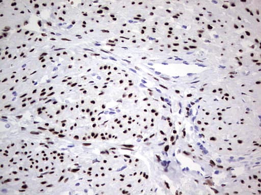 PR / Progesterone Receptor Antibody (aa1-298, clone OTI34G6)