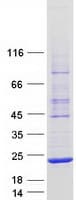 Human AARD Protein (Recombinant Myc-DDK (Flag))