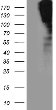 Monoclonal Mouse anti-Human SORL1 Antibody (clone OTI2D5, Carrier-free, aa573-753, IHC, WB)