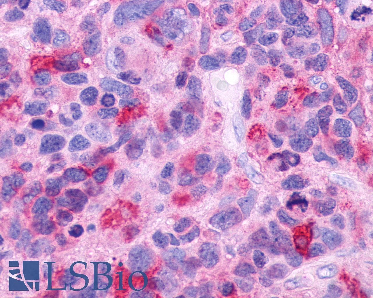 PathPlus™ GPR39 Antibody (Extracellular Domain)