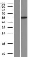 DEPDC1B Protein (Over-Expression Lysate Myc-DDK (Flag))