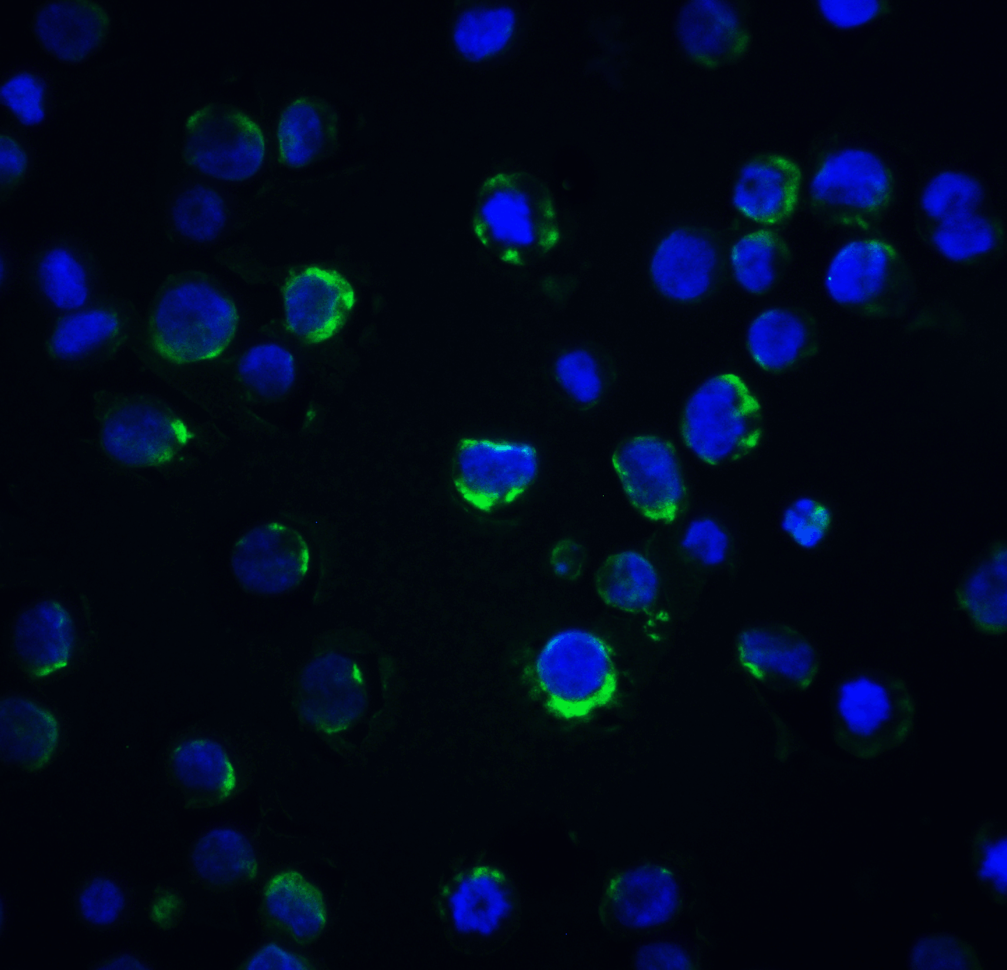 Polyclonal Rabbit anti-Human ACIN1 / Acinus Antibody (IF, WB)
