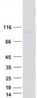 Human WDR43 Protein (Recombinant Myc-DDK (Flag))