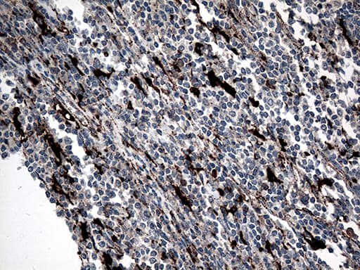 Monoclonal Mouse anti-Human CTSL / Cathepsin L Antibody (clone OTI2C10, Carrier-free, aa114-333, IHC, WB)