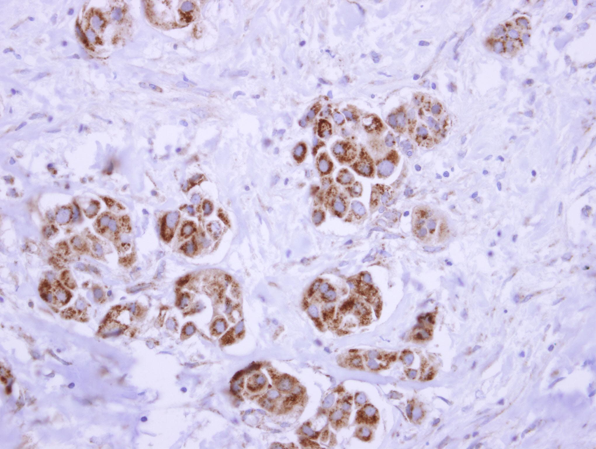 ATP5D Antibody (aa1-168)