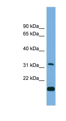CTDSP2 Antibody (C-Terminus)