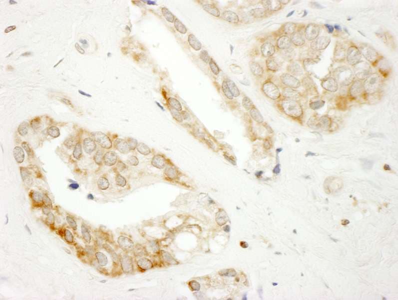 DOCK4 Antibody (aa1725-1775)